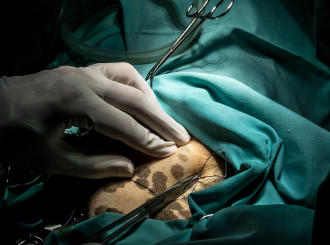 Cirugías con mínima invasión por endoscopia en Madrid